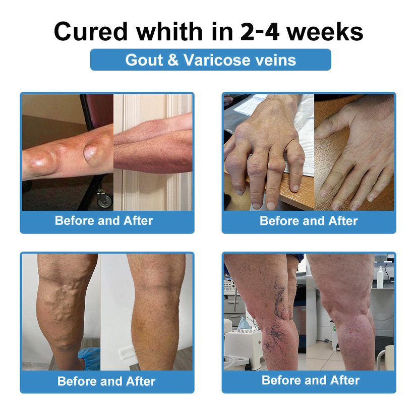 [New Year Special Offer] CureVivo® Pain Relief& Repair Lotion👩‍⚕️For Muscle, Joint & Nerve Pain