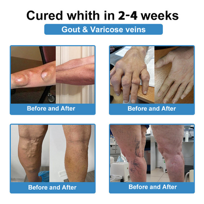 [New Year Special Offer] CureVivo® Pain Relief& Repair Lotion👩‍⚕️For Muscle, Joint & Nerve Pain