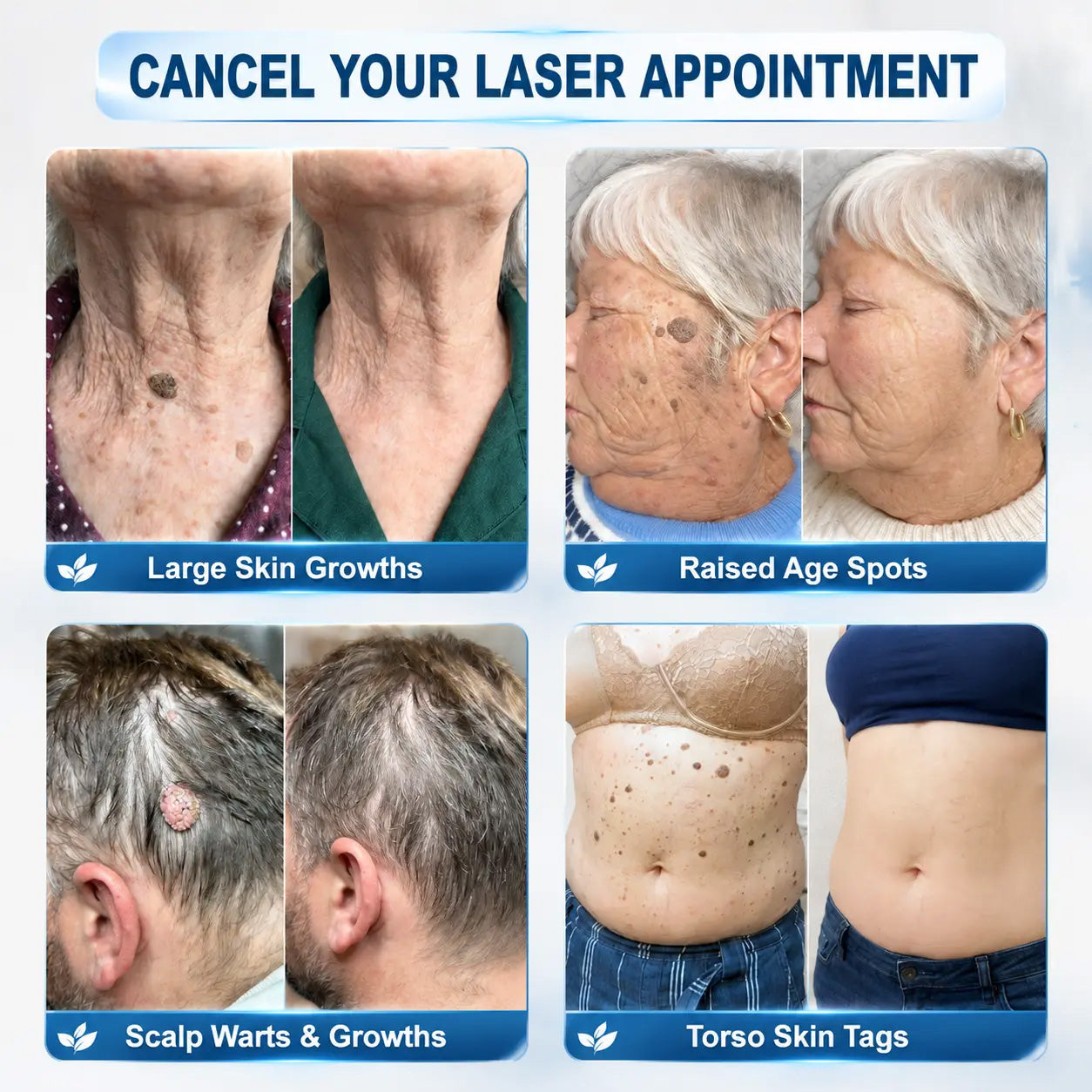 🛡️ 𝟓𝟎% 𝐎𝐅𝐅 | 𝐎𝐅𝐅𝐈𝐂𝐈𝐀𝐋 𝐂𝐔𝐑𝐄𝐕𝐈𝐕𝐎® 𝐒𝐓𝐎𝐑𝐄 | 𝟕-𝐃𝐚𝐲 𝐒𝐤𝐢𝐧 𝐓𝐚𝐠 & 𝐒𝐩𝐨𝐭 𝐄𝐫𝐚𝐬𝐞𝐫 𝐂𝐫𝐞𝐚𝐦 – 𝐆𝐌𝐏-𝐌𝐚𝐧𝐮𝐟𝐚𝐜𝐭𝐮𝐫𝐞𝐝 𝐁𝐨𝐭𝐚𝐧𝐢𝐜𝐚𝐥 𝐅𝐨𝐫𝐦𝐮𝐥𝐚