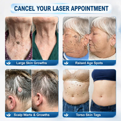 🛡️ 𝟓𝟎% 𝐎𝐅𝐅 | 𝐎𝐅𝐅𝐈𝐂𝐈𝐀𝐋 𝐂𝐔𝐑𝐄𝐕𝐈𝐕𝐎® 𝐒𝐓𝐎𝐑𝐄 | 𝟕-𝐃𝐚𝐲 𝐒𝐤𝐢𝐧 𝐓𝐚𝐠 & 𝐒𝐩𝐨𝐭 𝐄𝐫𝐚𝐬𝐞𝐫 𝐂𝐫𝐞𝐚𝐦 – 𝐆𝐌𝐏-𝐌𝐚𝐧𝐮𝐟𝐚𝐜𝐭𝐮𝐫𝐞𝐝 𝐁𝐨𝐭𝐚𝐧𝐢𝐜𝐚𝐥 𝐅𝐨𝐫𝐦𝐮𝐥𝐚