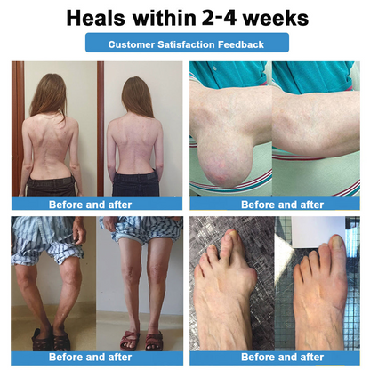 [New Year Special Offer] CureVivo® Pain Relief& Repair Lotion🎅For Muscle, Joint & Nerve Pain