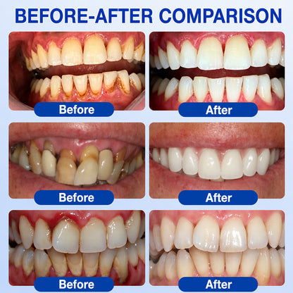 🦷 Trilumia® GumRevive – Advanced Gel for Gum & Periodontal Care