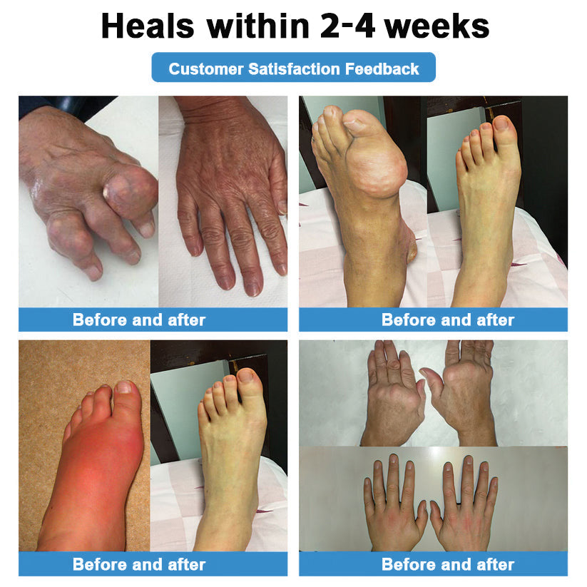 [New Year Special Offer] CureVivo® Pain Relief& Repair Lotion🎅For Muscle, Joint & Nerve Pain