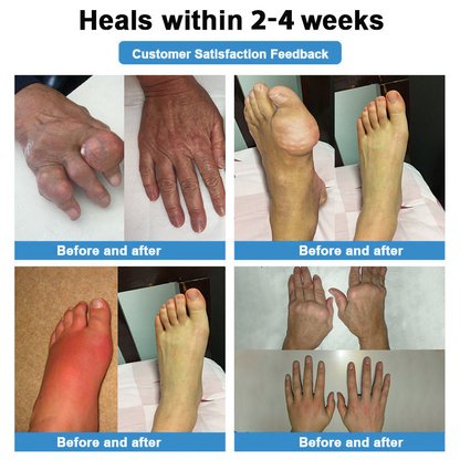 [New Year Special Offer] CureVivo® Pain Relief& Repair Lotion🎅For Muscle, Joint & Nerve Pain