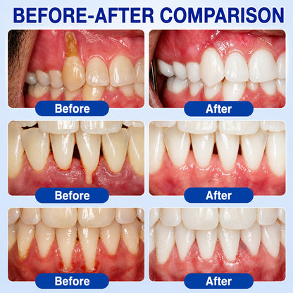 🦷 Trilumia® GumRevive – Advanced Gel for Gum & Periodontal Care