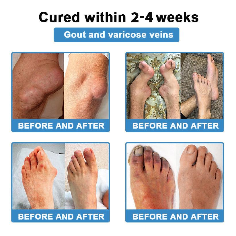 [New Year Special Offer] CureVivo® Pain Relief& Repair Lotion👩‍⚕️For Muscle, Joint & Nerve Pain