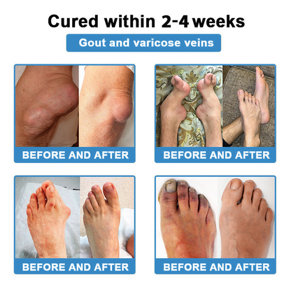 [New Year Special Offer] CureVivo® Pain Relief& Repair Lotion👩‍⚕️For Muscle, Joint & Nerve Pain