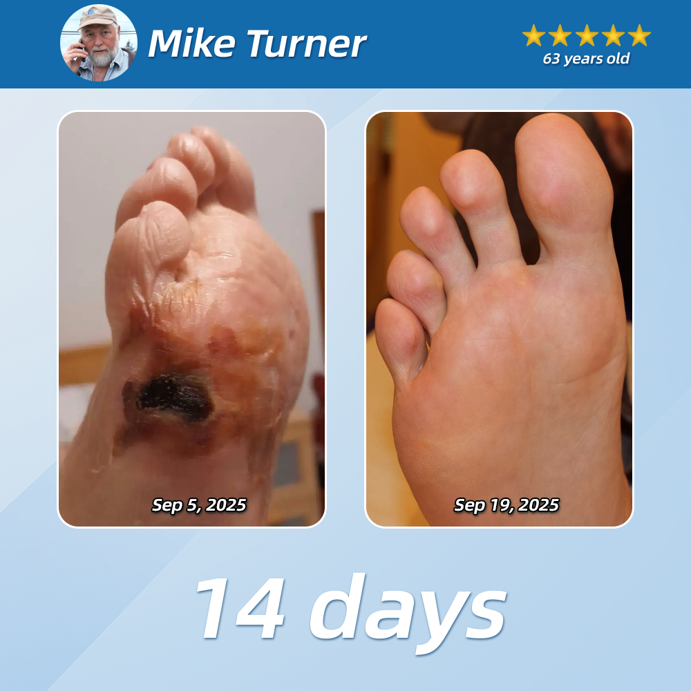 [New Year Special Offer] CureVivo® Pain Relief& Repair Lotion🥇For Muscle, Joint & Nerve Pain